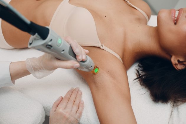 Laser Hair Removal: What To Expect